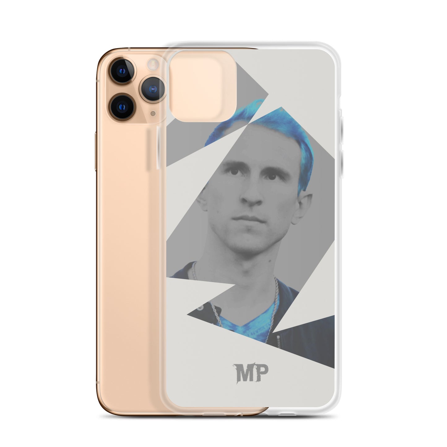 Light MP iPhone Case